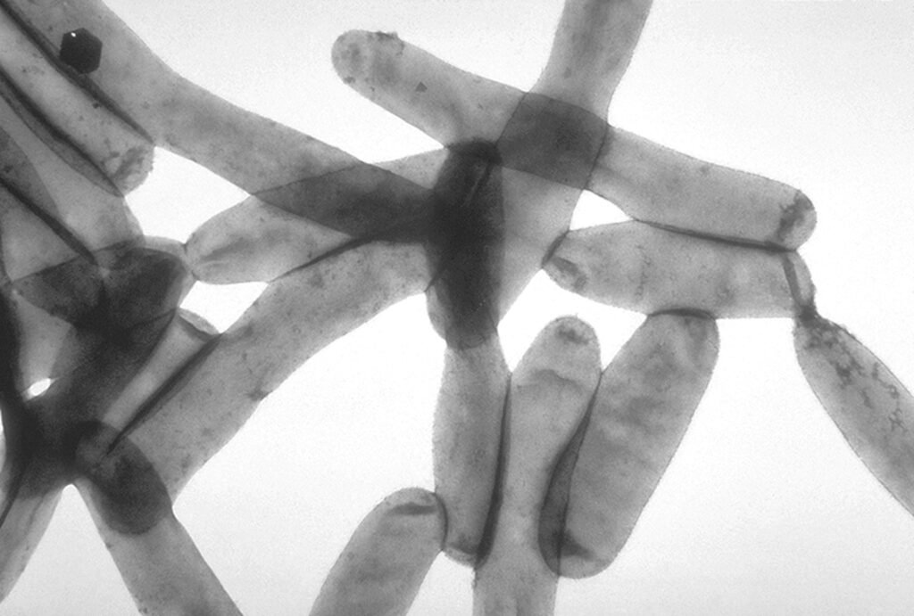 Microscope image of Legionella pneumophila bacteria