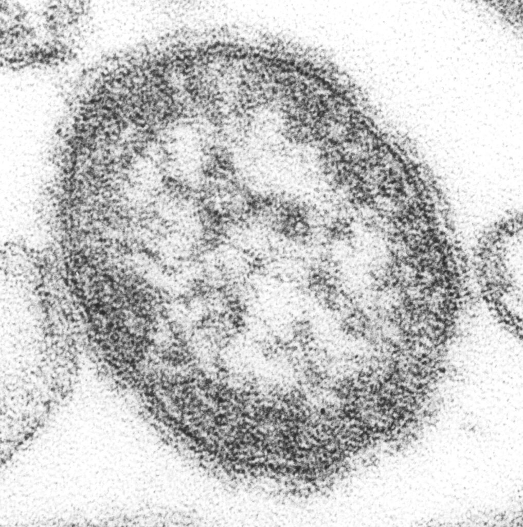 Colorized electron micrograph of measles virus particles