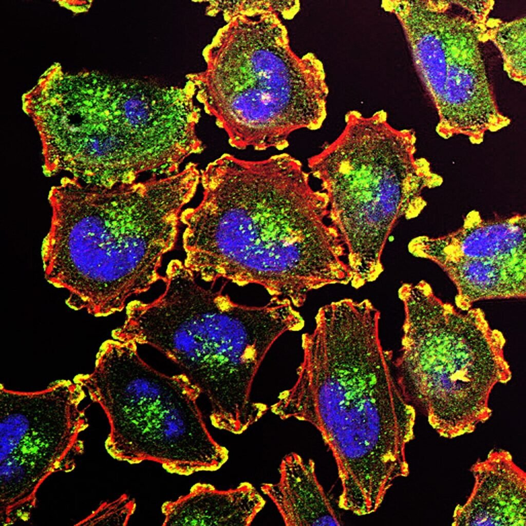 Fluorescence microscopy showing metastatic melanoma cells in multiple colors