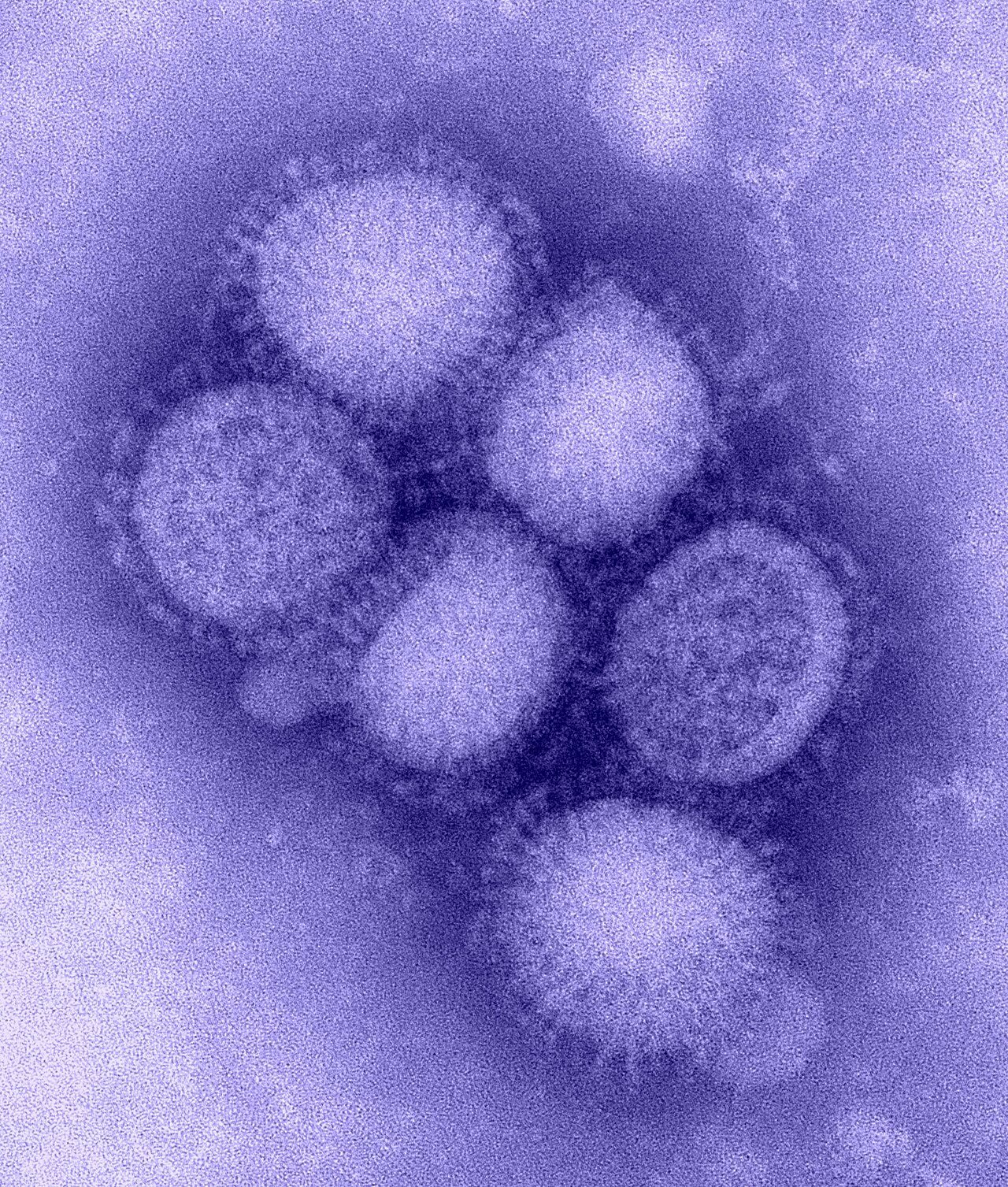 Archival laboratory image of H1N1 influenza virus particles